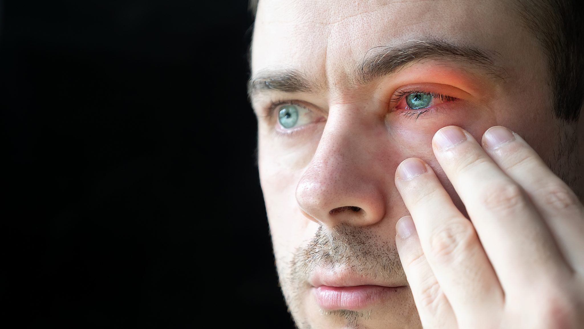 Demodex Mites I Have WHAT in my Eyelids? Eyecare Eyewear