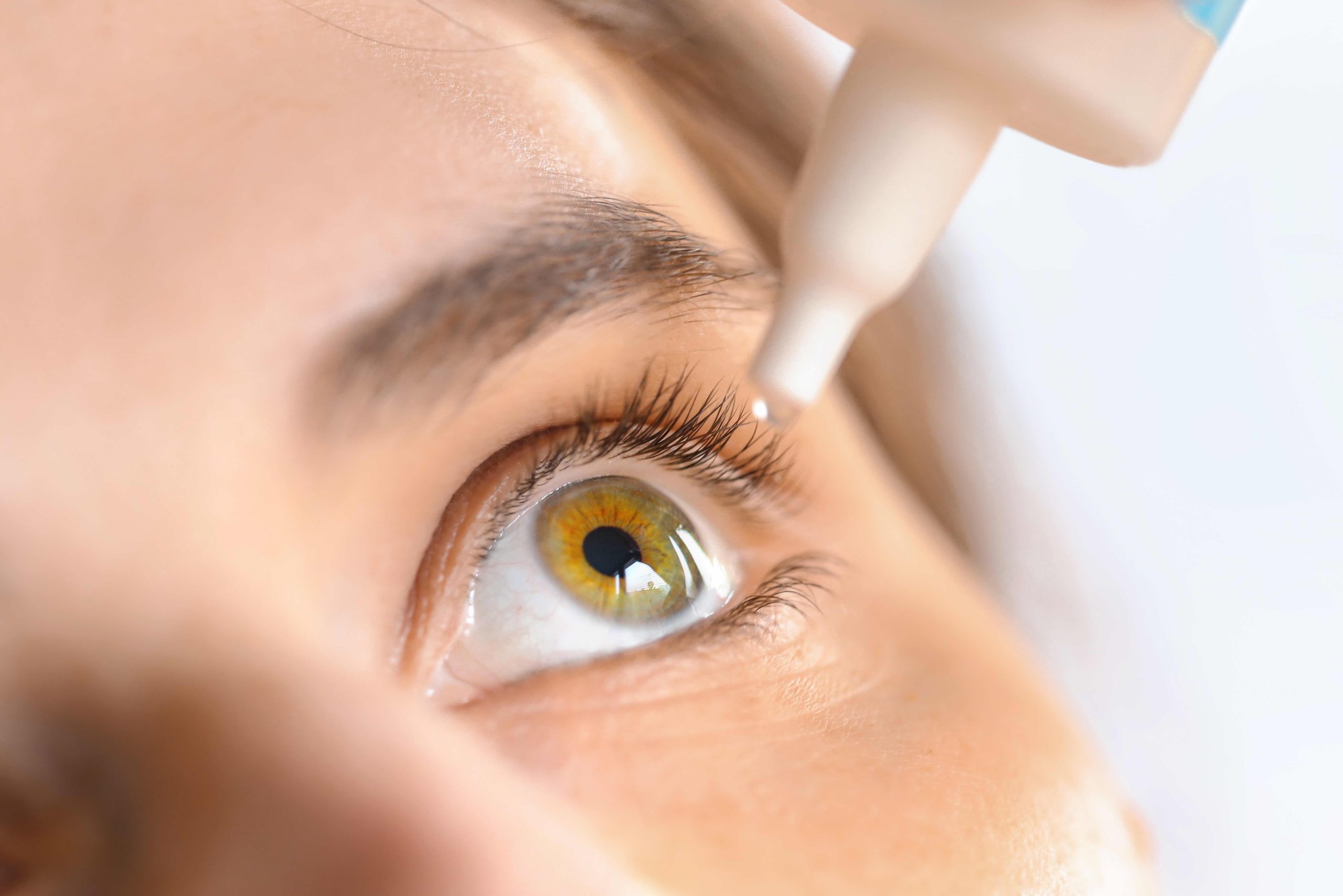 Woman applying eye drop. Vitamin drops from tiredness and redness eyes. Suffering from irritated eye,optical symptoms.